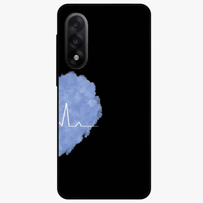 Blue Pulse Bond Glass Case for 1+Nord 5 bold front view featuring dynamic blue abstract pulse artwork