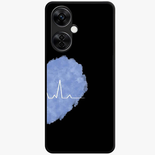 Blue Pulse Bond Glass Case for 1+Nord CE 3 Lite bold front view featuring dynamic blue abstract pulse artwork