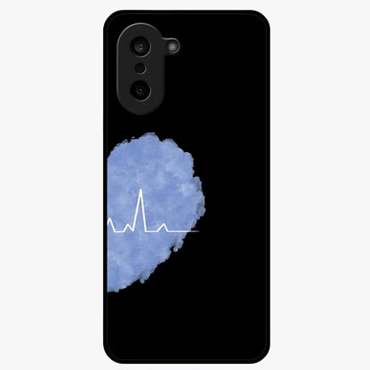 Blue Pulse Bond Glass Case for 1+Nord CE 5 bold front view featuring dynamic blue abstract pulse artwork